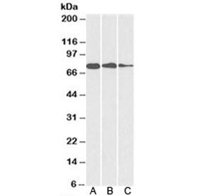 GRP78 Antibody (BiP)