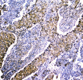 LRTOMT Antibody