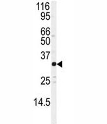 Western blot analysis of JUND antibody and Jurkat lysate. Predicted molecular weight: ~39/34kDa (JUN