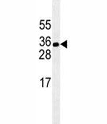 HuR Antibody (ELAVL1)