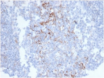 IHC staining of FFPE human colon tissue with CD23 antibody (clone FCER2/6890) at 2ug/ml in PBS for 3