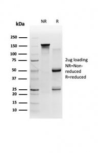 SDS-PAGE analysis of purified, BSA-free 58K Golgi protein antibody (clone FTCD/357) as confirmation 