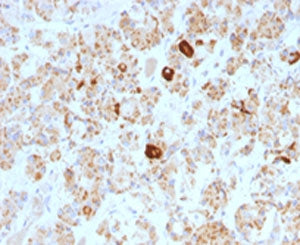 IHC testing of formalin-fixed, paraffin-embedded human pituitary stained with Luteinizing Hormone be