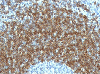 IHC testing of FFPE human tonsil tissue with CD79b antibody (clone CDLA79b-1). HIER: boil tissue sec