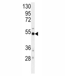 BACE Antibody