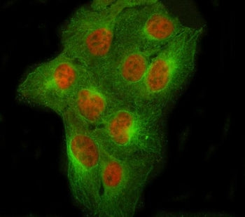 Immunofluorescent staining of FFPE human U-2 OS cells with NCOR2 antibody (red) and Beta Tubulin mAb