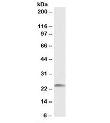 Western blot testing of human muscle lysate with HSP22 antibody at 1ug/ml. Observed molecular weight