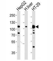 HGFR Antibody (MET)