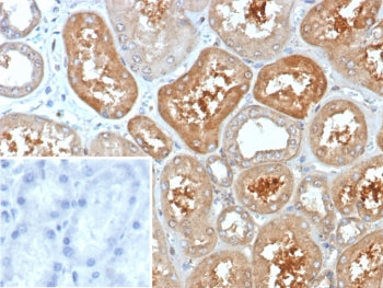 IHC staining of FFPE human kidney tissue with KCNIP2 antibody (clone KCNIP2/7588). Inset: PBS used i