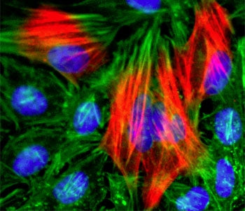 Calponin 1 Antibody