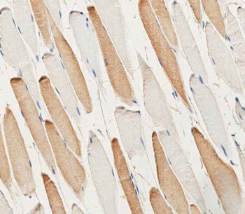 Myosin Light Chain 2 Antibody / MLC2 / MYL2