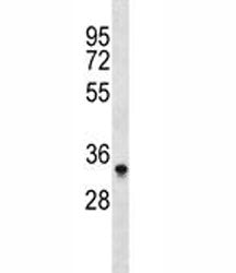 Aurora-B Antibody (Aurkb)