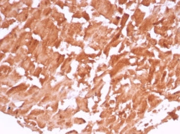 IHC staining of FFPE human heart tissue with VEGF antibody (clone VEGFA/7636R). HIER: boil tissue se