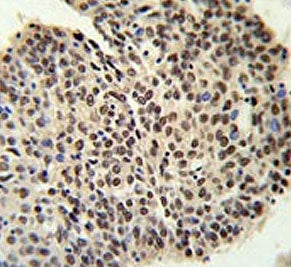 PRP19 Antibody / Pre-mRNA-processing factor 19 / PRPF19
