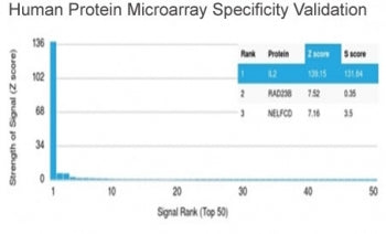 IL-2 Antibody