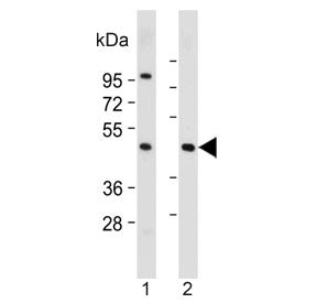Western blot testing of human 1) HepG2 and 2) skeletal muscle lysate with ASAM antibody. Predicted m