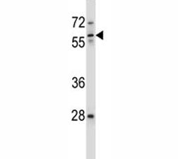 ICAM3 antibody western blot analysis in ZR-75-1 lysate. Observed molecular weight: 60~120 kDa depend