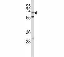 Alkaline Phosphatase Antibody (placental)