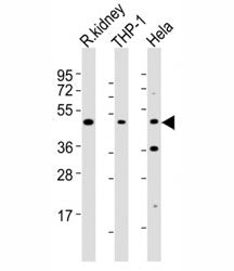 Western blot testing of BMP2 antibody at 1:2000 dilution. Lane 1: rat kidney lysate; 2: THP-1 lysate
