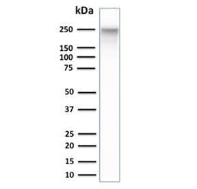 Western blot testing of human PANC-1 cell lysate with Spectrin beta III antibody. Predicted molecula