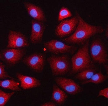 SERPINB9 Antibody / Serpin B9
