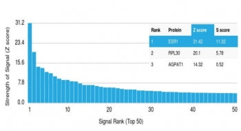 Estrogen Receptor alpha Antibody