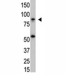 IKK beta Antibody