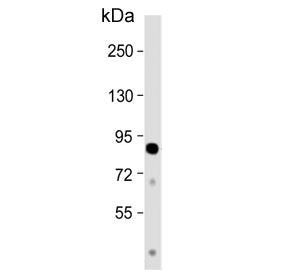 Western blot testing of human heart tissue lysate with CCHCR1 antibody. Predicted molecular weight ~