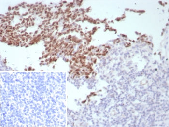 Bcl6 Antibody