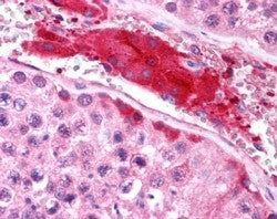 IHC testing of FFPE human testis with HRS antibody at 2.5ug/ml. HIER: steamed with pH6 citrate buffe