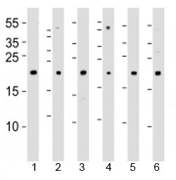Western blot analysis of lysate from 1) 293T, 2) HeLa, 3) Jurkat, 4) Y79 cell line , 5) mouse spleen