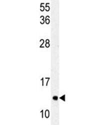 LC3C Antibody / MAP1LC3C, 0.4ml