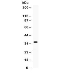 Western blot testing of human SMMC cell lysate with TREX1 antibody. Expected/observed molecular weig