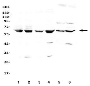 Western blot testing of 1) human HeLa, 2) human Jurkat, 3) human A549, 4) human Raji, 5) rat liver a