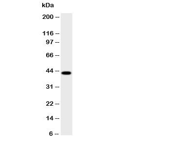 HSD17B2 Antibody