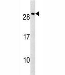 NKX2.8 Antibody