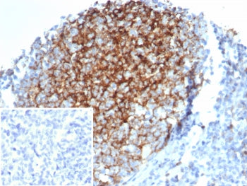 IHC staining of FFPE human tonsil tissue with CD23 antibody; Membrane staining observed with FCER2/6
