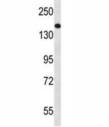 NPC1 antibody western blot analysis in NCI-H460 lysate. Predicted molecular weight ~142/170~190 kDa 