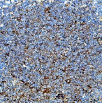 IHC staining of FFPE mouse spleen with Cd63 antibody. HIER: boil tissue sections in pH8 EDTA for 20 