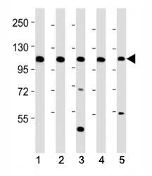Western blot testing of Mertk antibody at 1:2000 dilution. Lane 1: mouse kidney lysate; 2: mouse liv