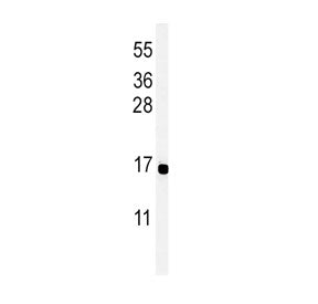 Peptide YY Antibody / PYY