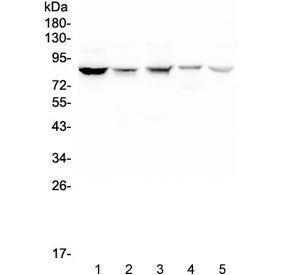 Western blot testing of human 1) HeLa, 2) placenta, 3) SCG-7901, 4) Jurkat and 5) THP-1 lysate with 