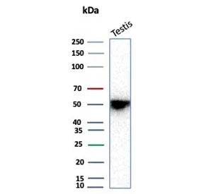 Recombinant INHA Antibody / Inhibin alpha