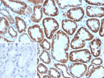 IHC staining of FFPE human kidney tissue with FGF23 antibody (clone FGF23/8940). Inset: PBS used in 