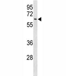 Western blot analysis of EIF2A antibody and Ramos lysate. Predicted molecular weight: 62, 58, 41 kDa