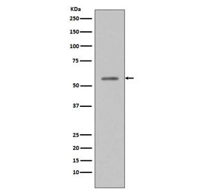 Phospho-p53 Antibody / TP53 (pS33)