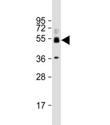 Western blot testing of human ovary lysate with SH3BP5 antibody at 1:2000. Predicted molecular weigh