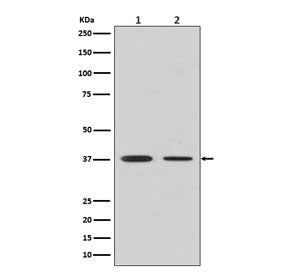 Western blot testing of human 1) fetal liver and 2) fetal lung lysate with Arginase 1 antibody. Pred