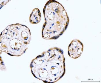 RYR2 Antibody / Ryanodine receptor 2