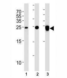 UCHL1 antibody western blot analysis in (1) 293T, (2) NCI-H1299 and (3) rat PC-12 lysate. Predicted 